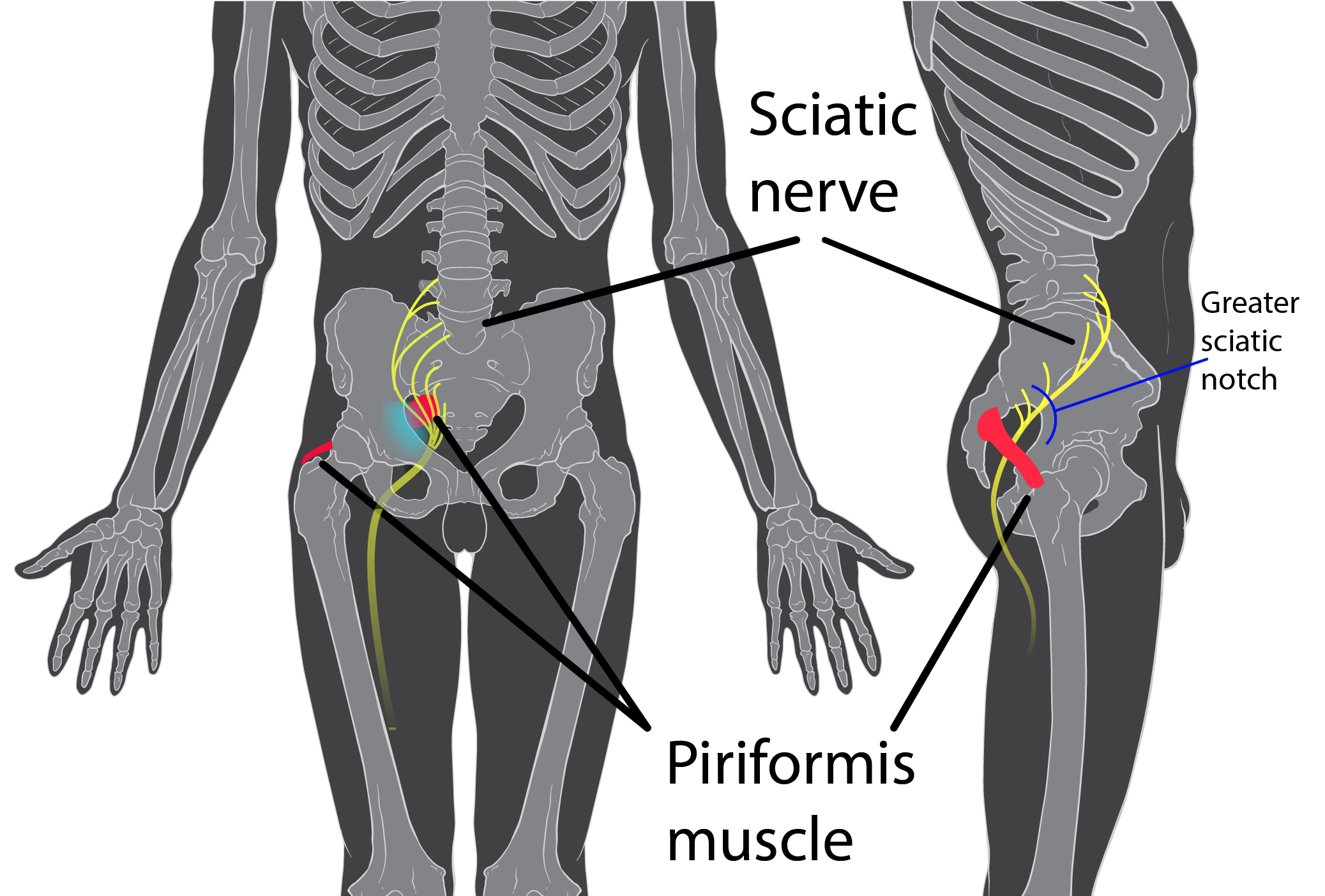 roseata dureri articulare durere în articulația cotului ligamentului