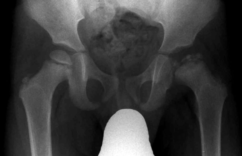 CT scan of lumbar spine - DocCheck