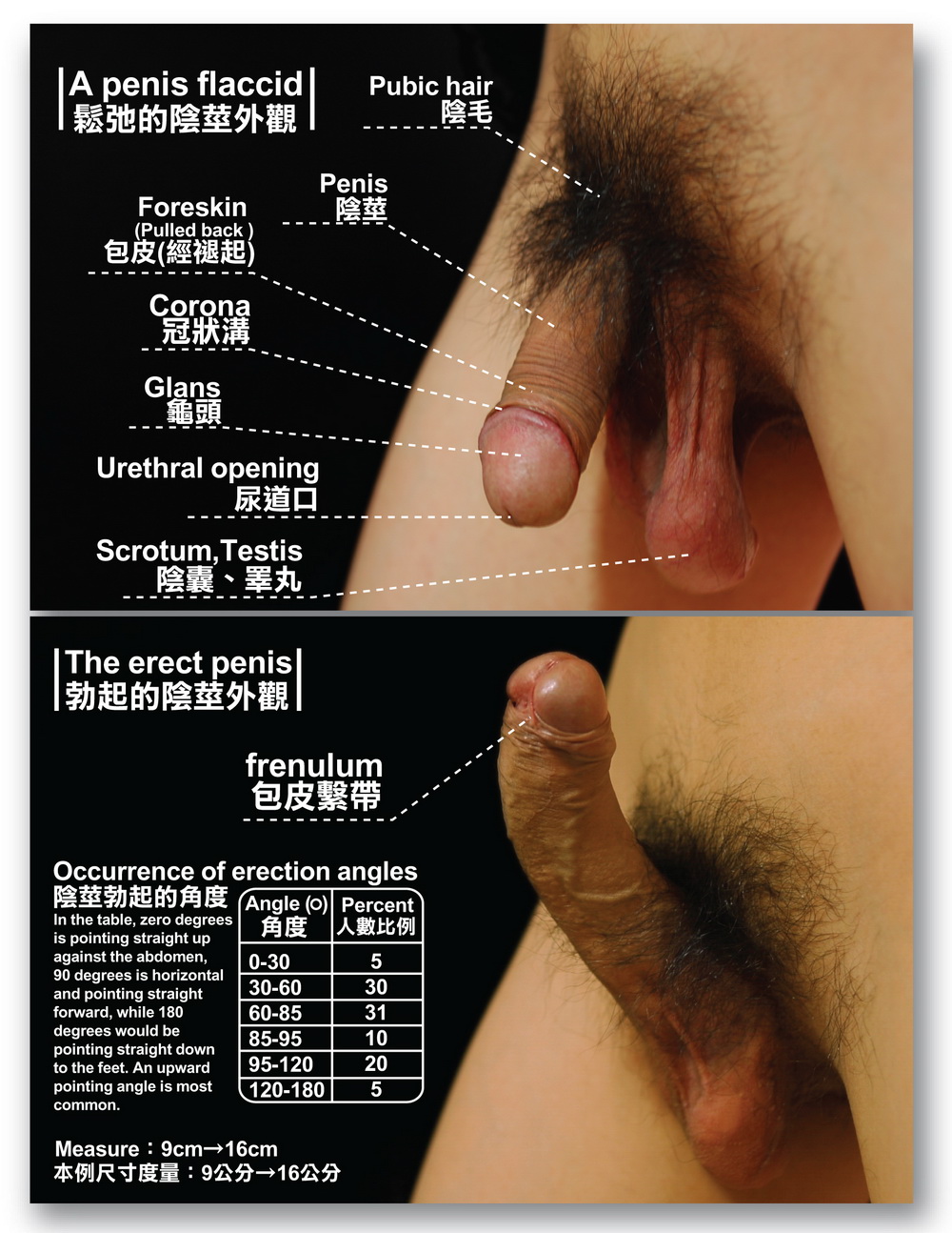 File:Penile erection Example-tw.jpg - Wikimedia Commons.