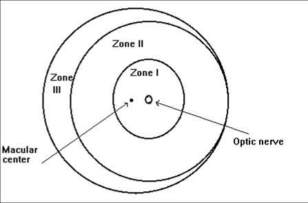 File:ROP zones.jpg