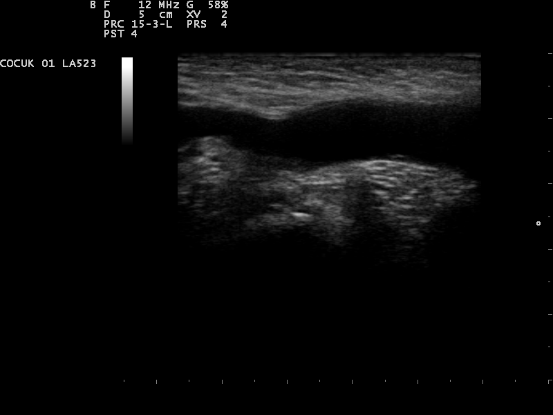 File:Ultrasound Scan ND 0124155309 1554120.png