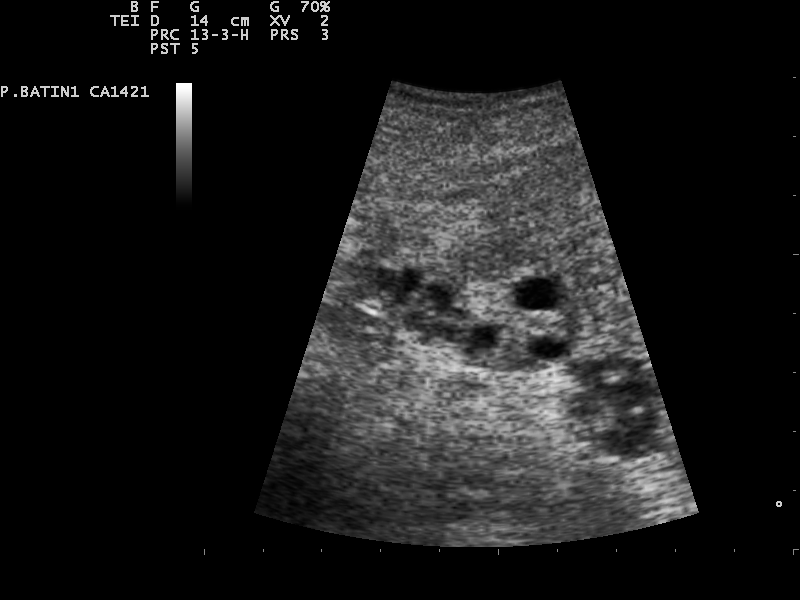 File:Ultrasound Scan ND 0128134059 1346280.png