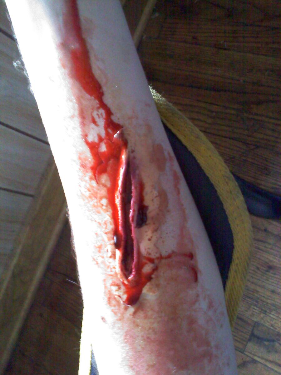 real bleeding arm