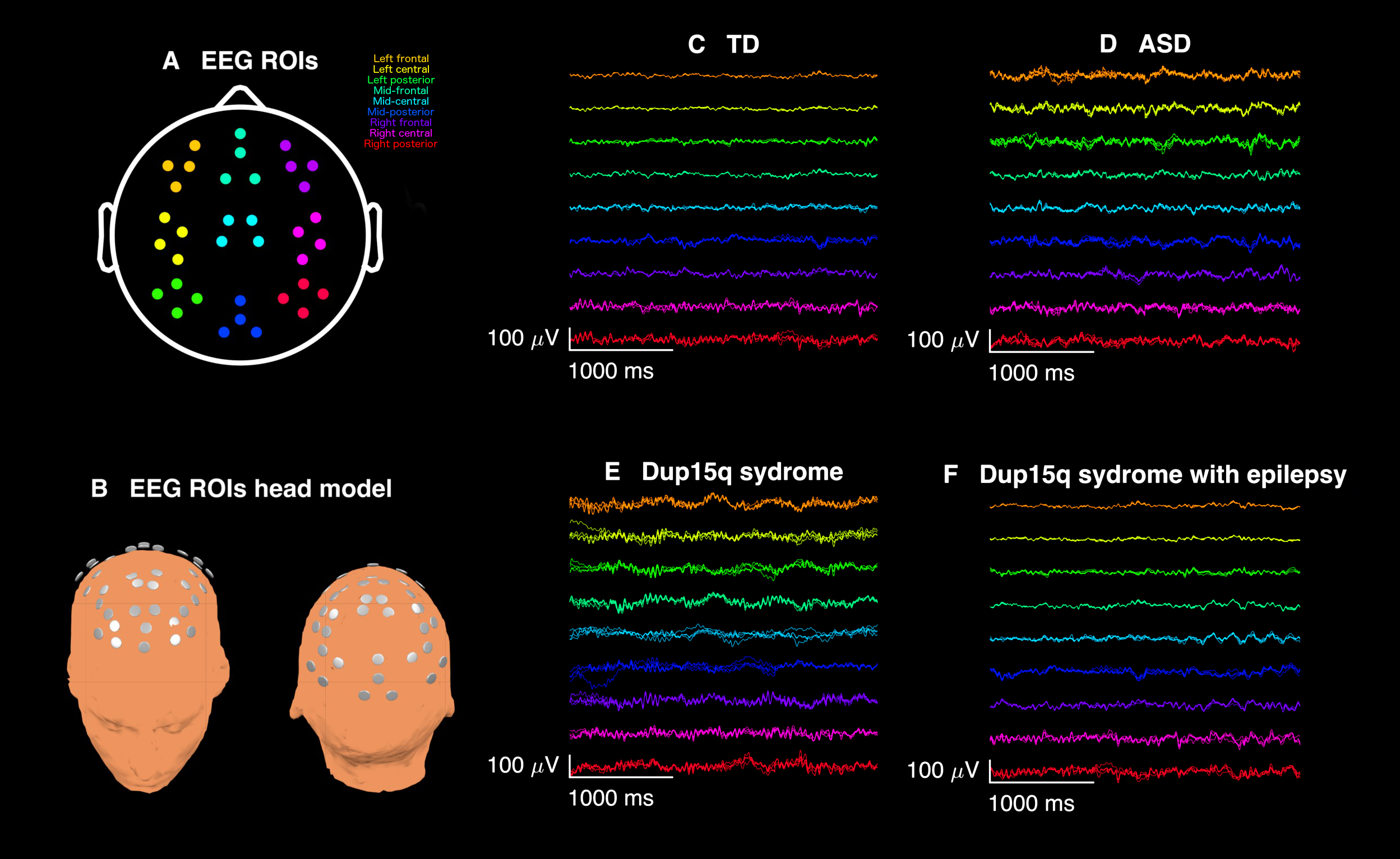 Ээг сигнал. ЭЭГ. Спектральные показатели ЭЭГ. Спектральный анализ ЭЭГ сигналов. Цветовая шкала ЭЭГ.