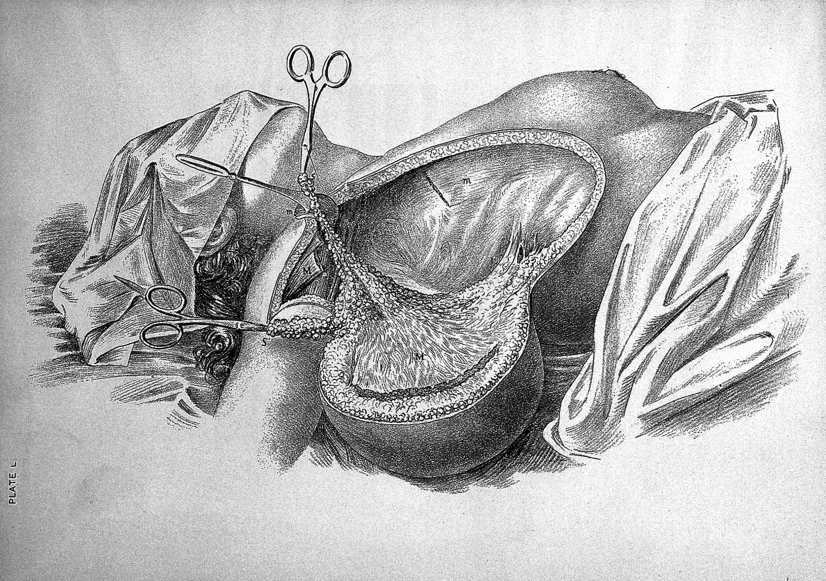File:Breast illustration.jpg - Wikimedia Commons