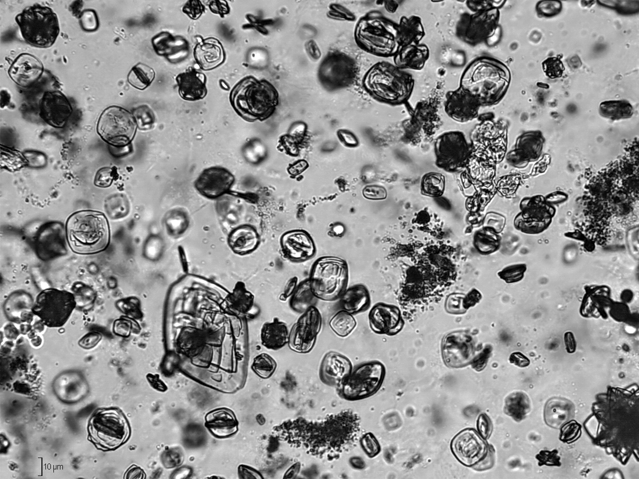 crystals in human urine