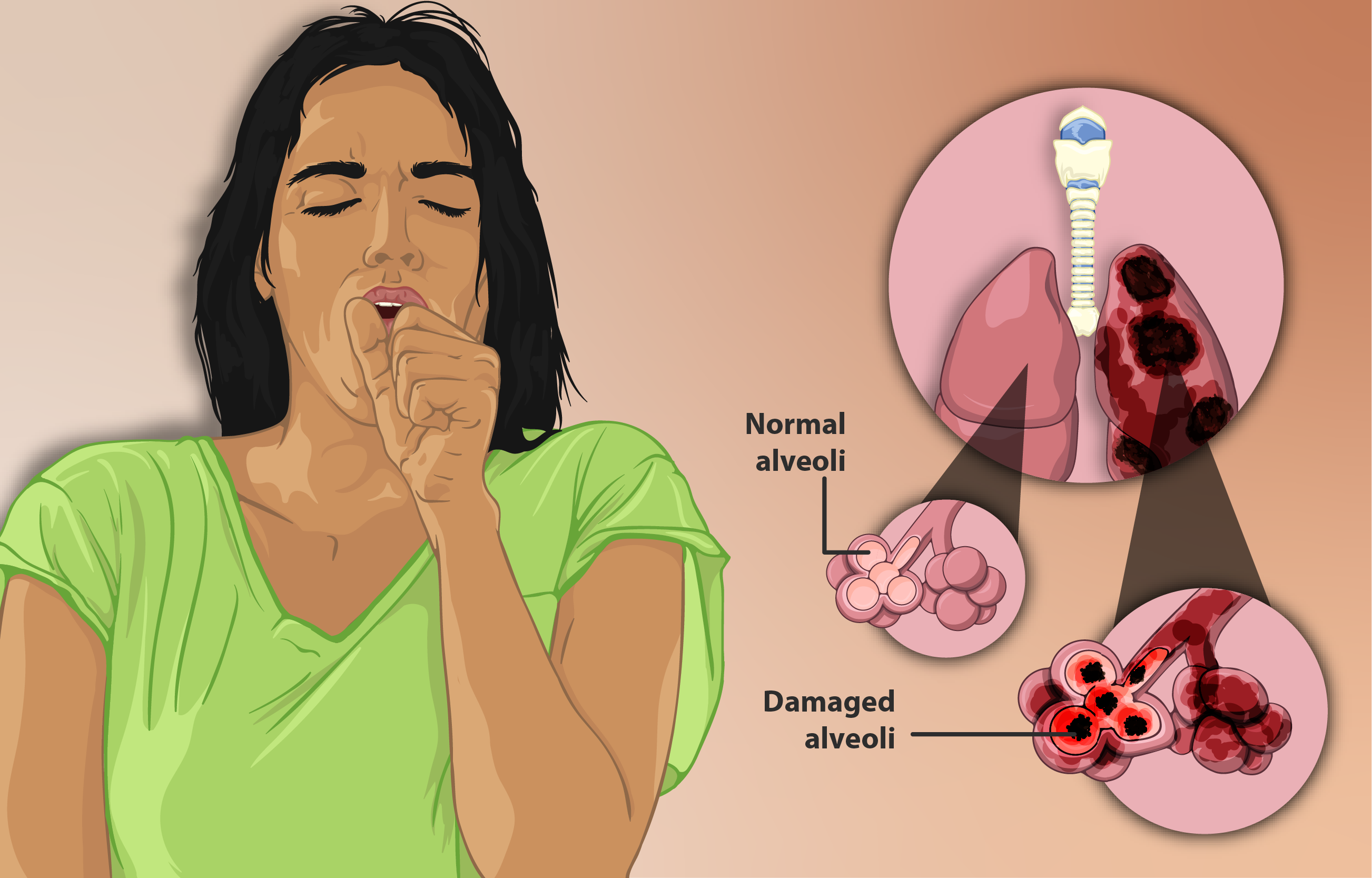 Depiction of a woman suffering from Emphysema, a type of Chronic Obstructive Pulmonary Disease.png