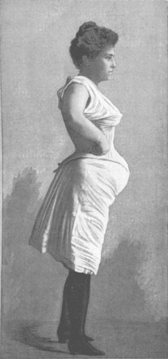 File:Fig8Forme des anciens corsets.jpg - Wikipedia