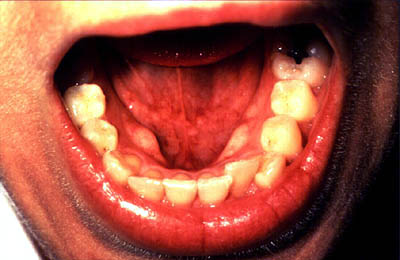 File:NIH DOC 12 MouthFloor.jpg