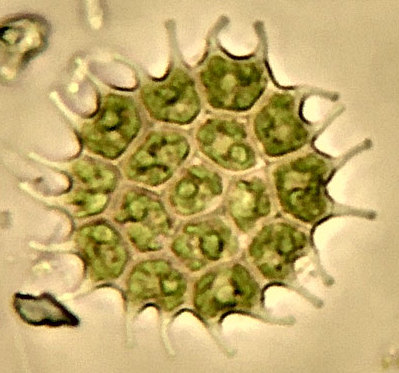 File:Pediastrum (cropped).jpg