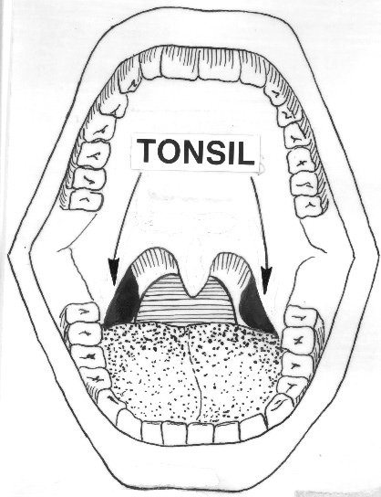 File:Tonsil (PSF).png