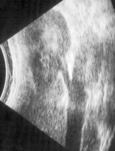 File:Ultrasound Scan ND 109.jpg