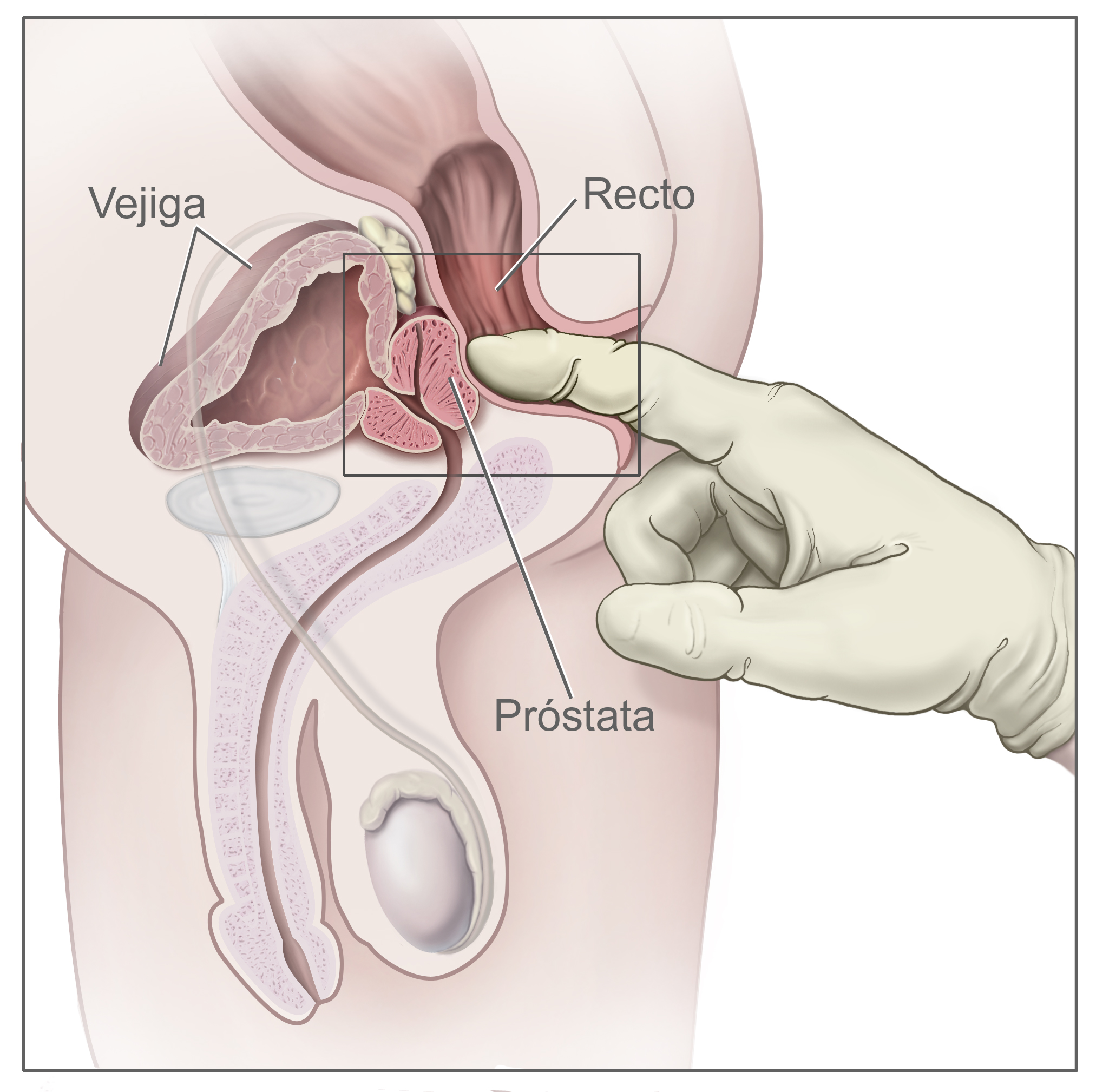 examen de la prostata en ingles