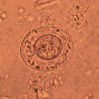 An egg of dwarf tapeworm