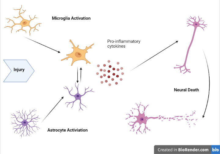 File:Neuroinflammation example.jpg