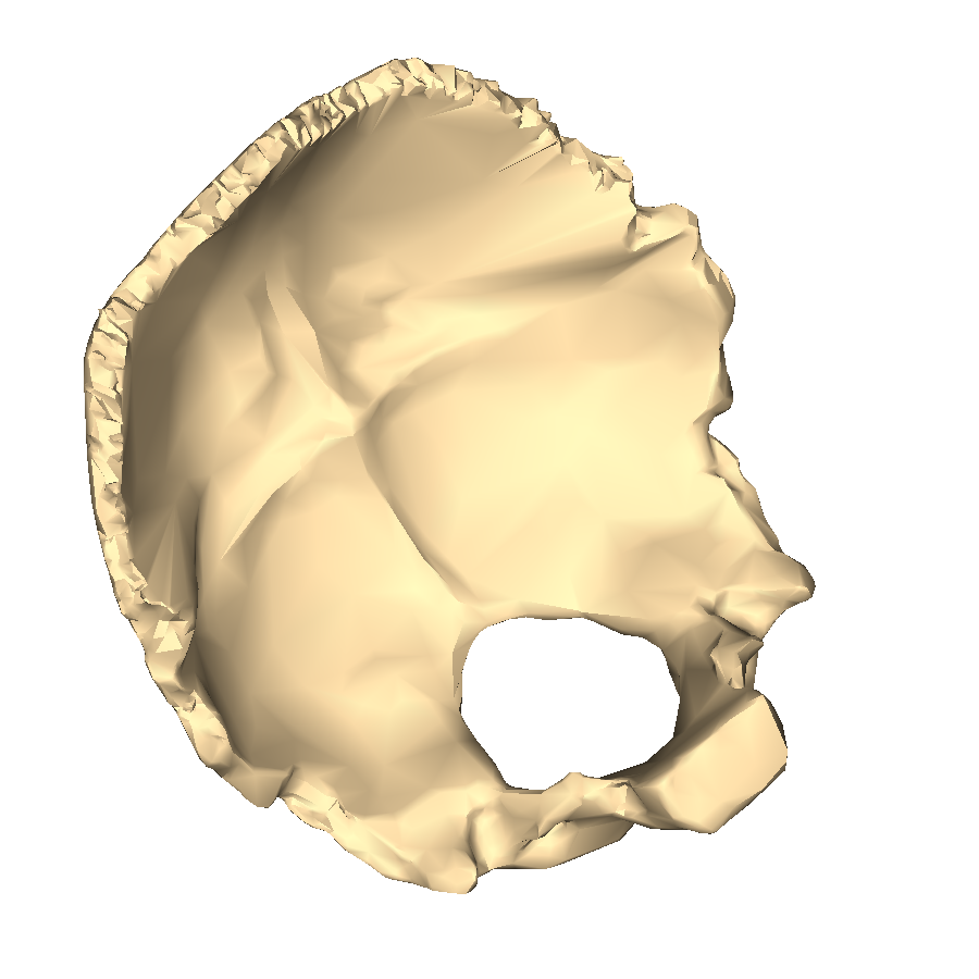 occipital bone unlabeled