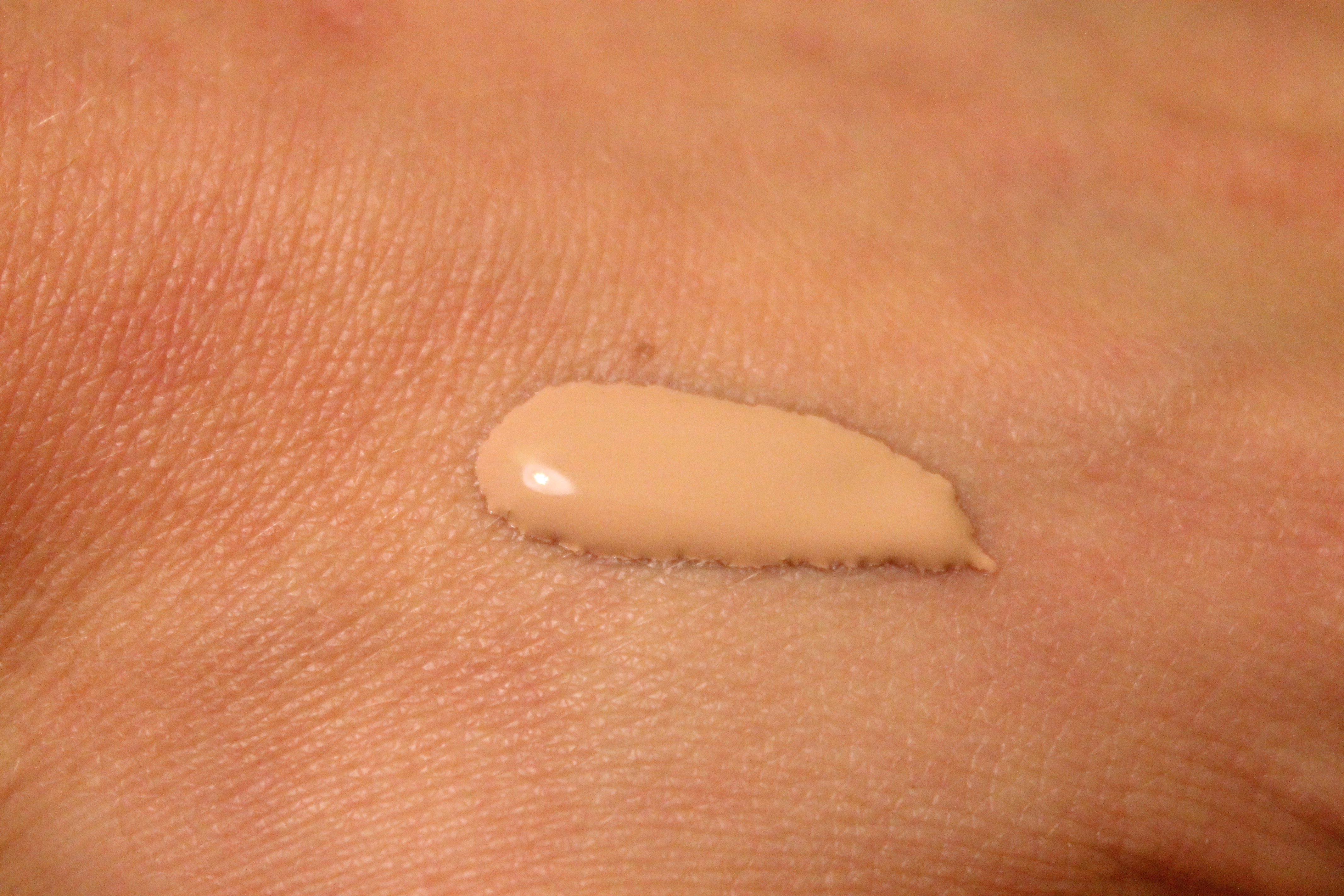 small white bumps on skin #10