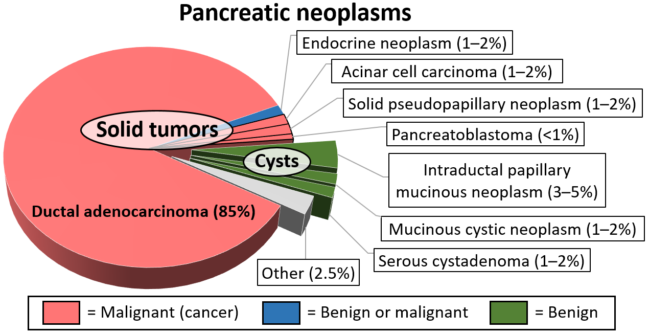 Pancreatic cyst