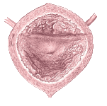 Links: Schematische Darstellung der anatomischen Verhältnisse zwischen Harnblase und Harnröhre, Rechts: Blick aus dem Inneren der Harnblase, dem Trigonum vesicae und als dem Ursprungsort der Urethra die zentral liegende Öffnung der inneren Harnröhrenmündung (Ostium urethrae internum)