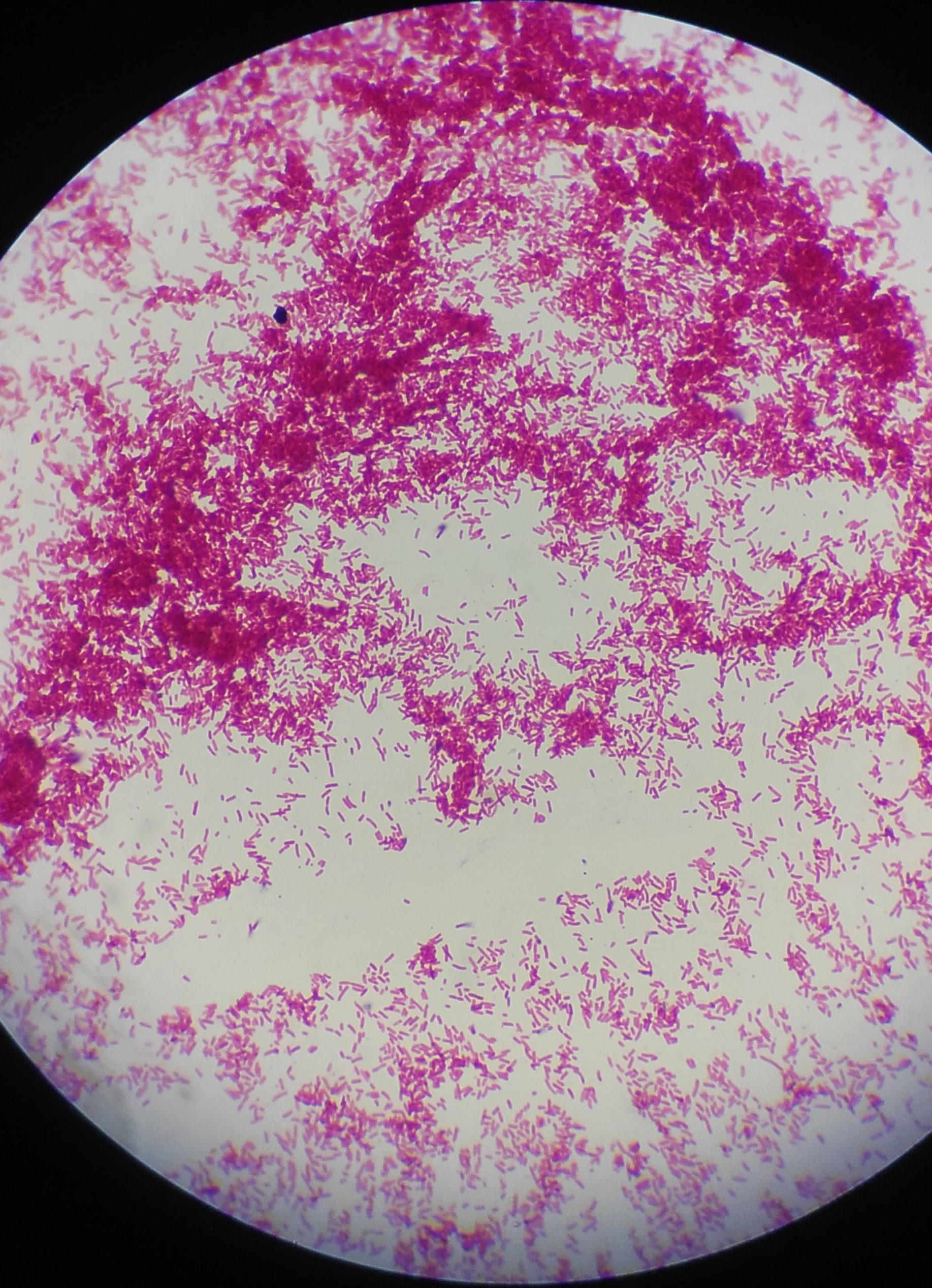 File:Staphylococcus aureus Gram stain.jpg - Wikimedia Commons