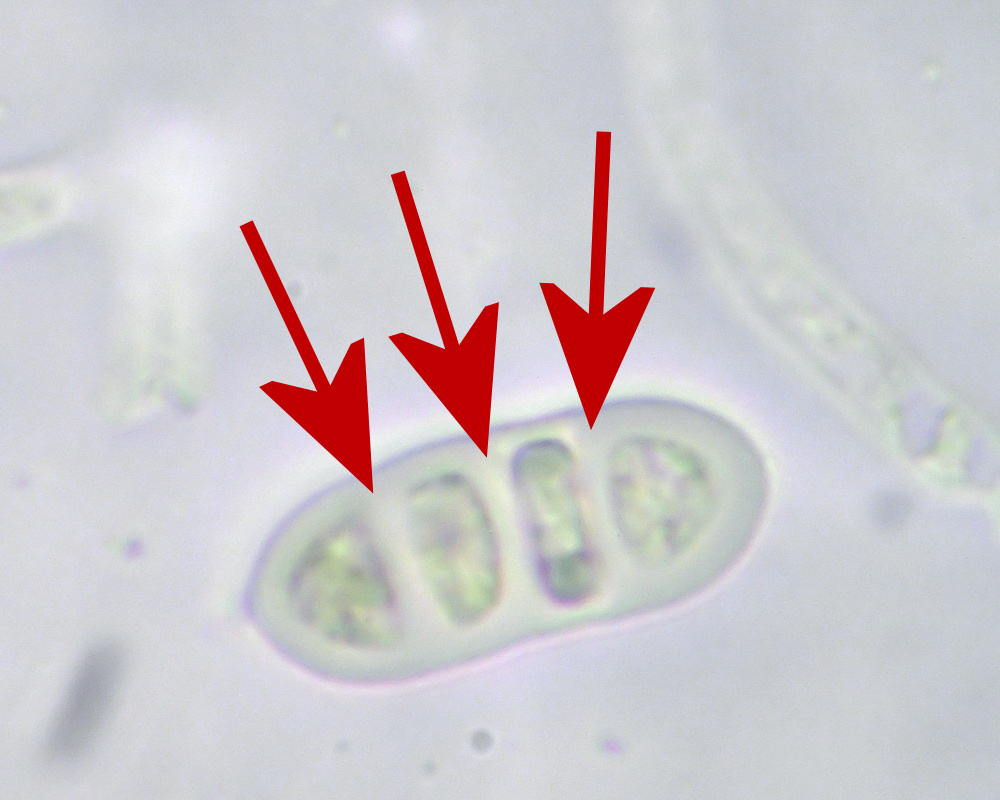 Студенистый осадок это. Dacrymyces stillatus.