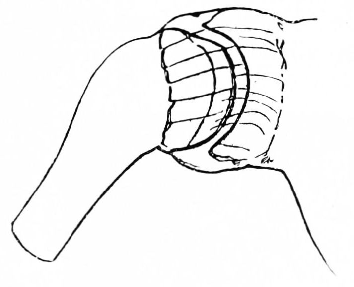 File:PSM V42 D776 Diagram of shoulder joint.jpg