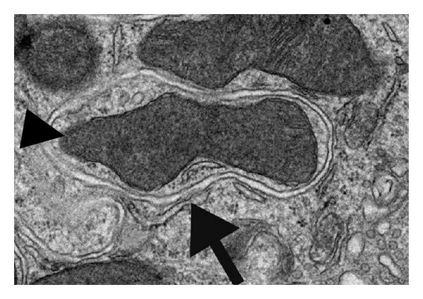 File:Autophagy in plants.jpg