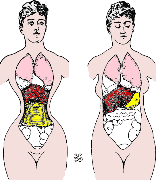 File:The effect of bending forward when seated with and without corsets.gif  - Wikimedia Commons