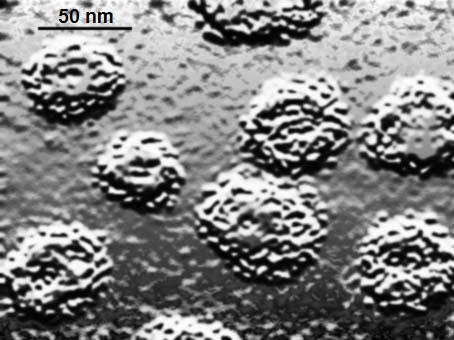 Fájl:EM of pap virus, 2C basal tissue grafted to mouse.jpg