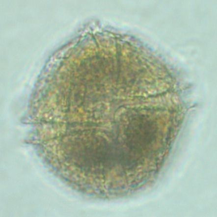 File:Lingulodinium polyedrum.jpg