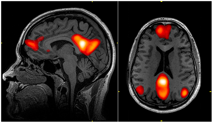 Large-scale functional brain networks in human non-rapid eye movement  sleep: insights from combined electroencephalographic/functional magnetic  resonance imaging studies