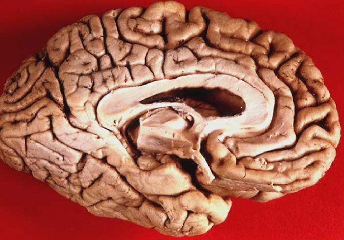 Datei Human Brain Inferior Medial View Jpg Wikibooks