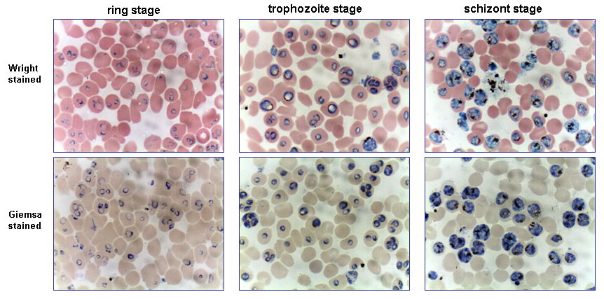 Plasmodium vivax- Habitat, Characteristics, Structure, Life cycle