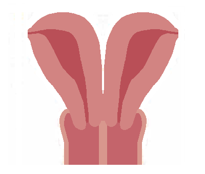 File:Uterus didelphys 1.png