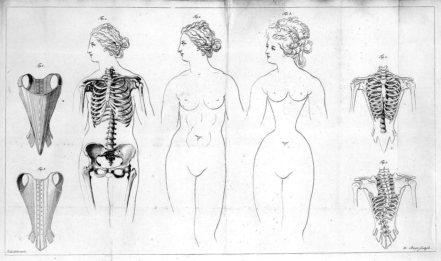 File:Distortions of the female rib-cage caused by corset. Wellcome