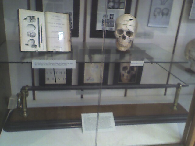 File:The skull of Phineas Gage.jpg