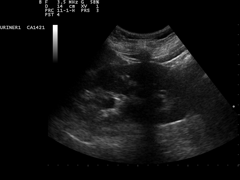 File:Ultrasound Scan ND 0106120652 1208580.png