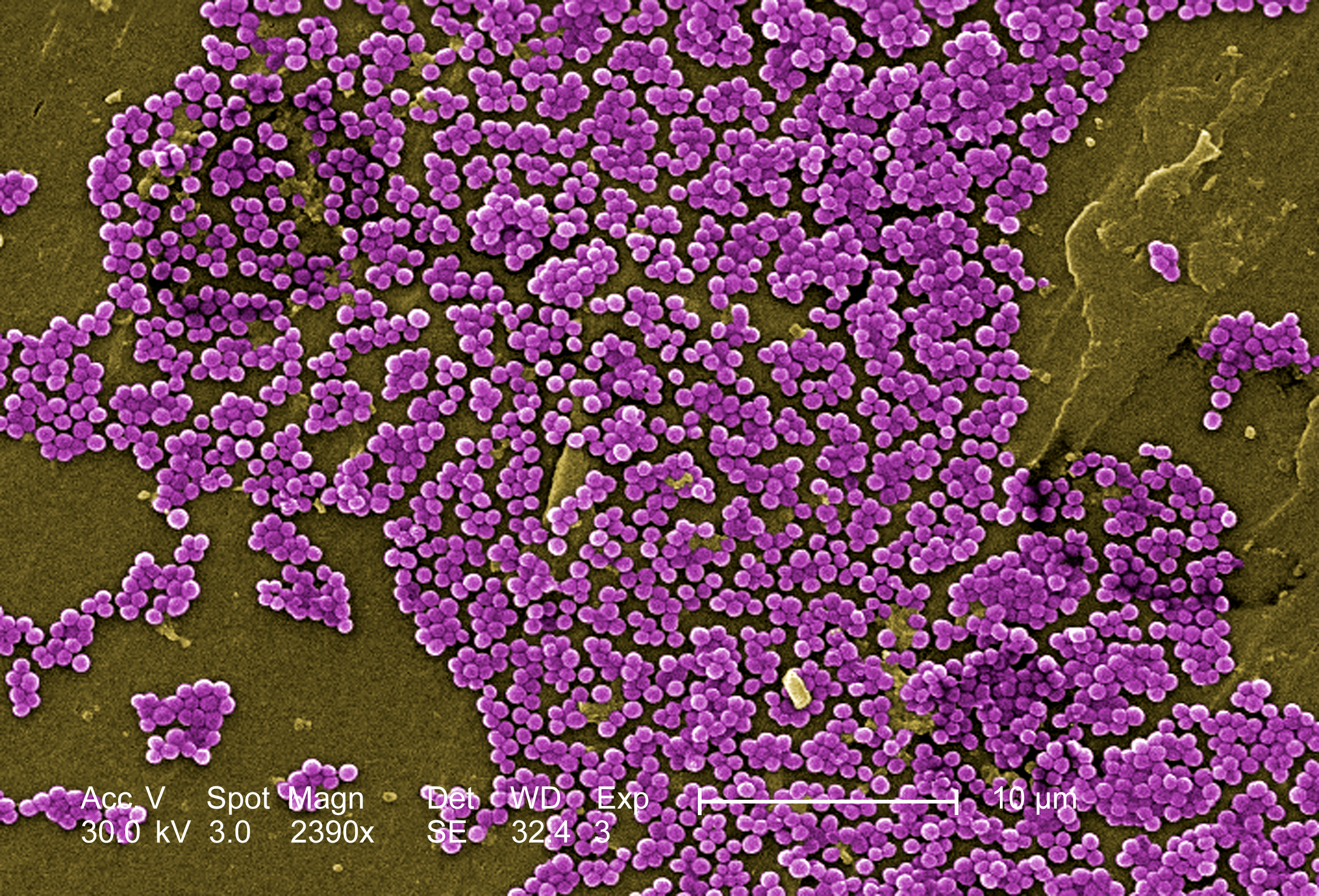 methicillin resistant staphylococcus aureus photos