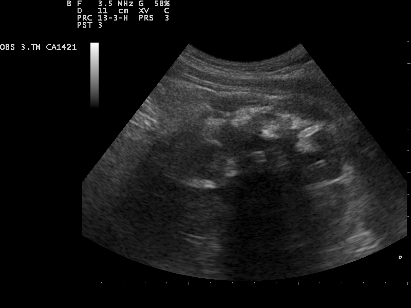 File:Ultrasound Scan ND 0111135210 1355111.png