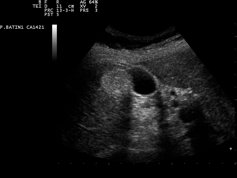 File:Ultrasound Scan ND 0128145808 1502170.png