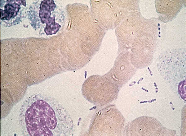 Wayson stain of Yersinia pestis showing the characteristic 