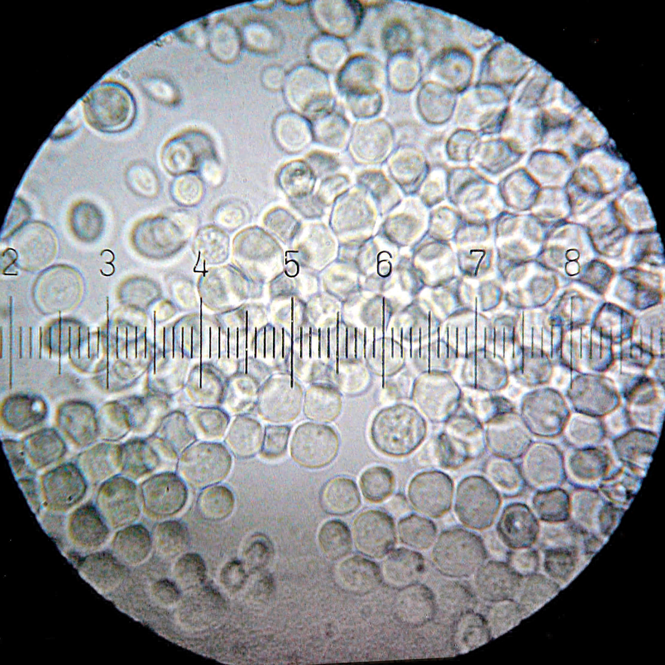 Microscopic observation of S. boulardii cells. (A) Oval and/or