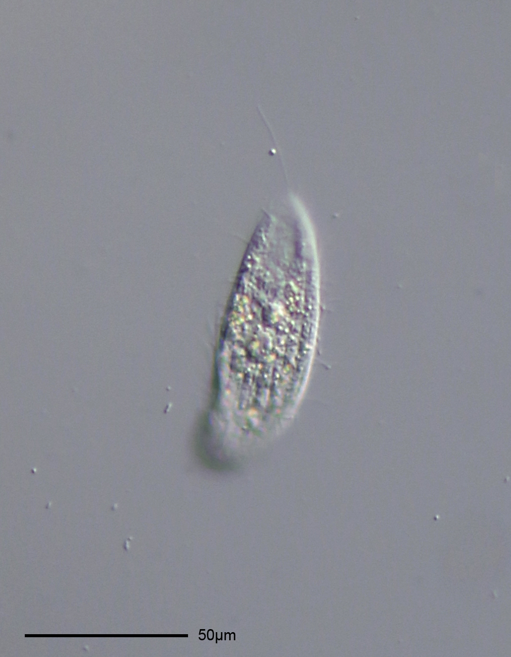 File:Ciliat (diagnosis pending) - 160x - Caudal cilium - 1  (14303830865).jpg - Wikimedia Commons