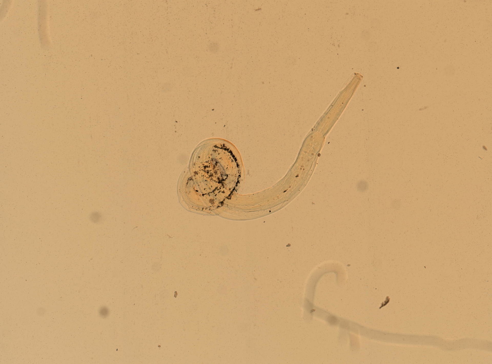 Enterobius vermicularis микроскоп