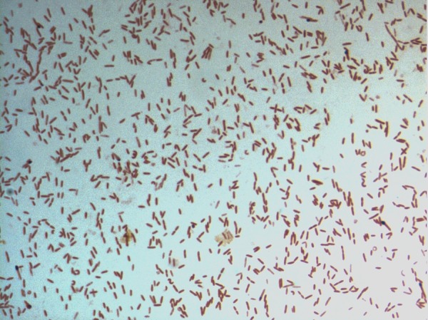 https://upload.wikimedia.org/wikipedia/commons/9/9d/Gram-staining-of-D.jpg