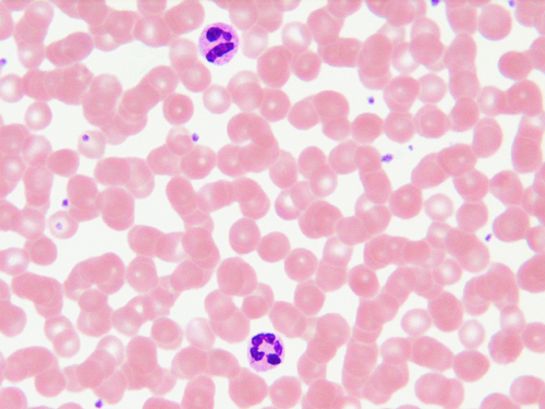 File:Blood-neutrophil3.jpg