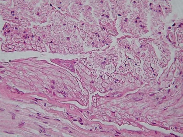 File:Peripheral nerve, cross section.jpg