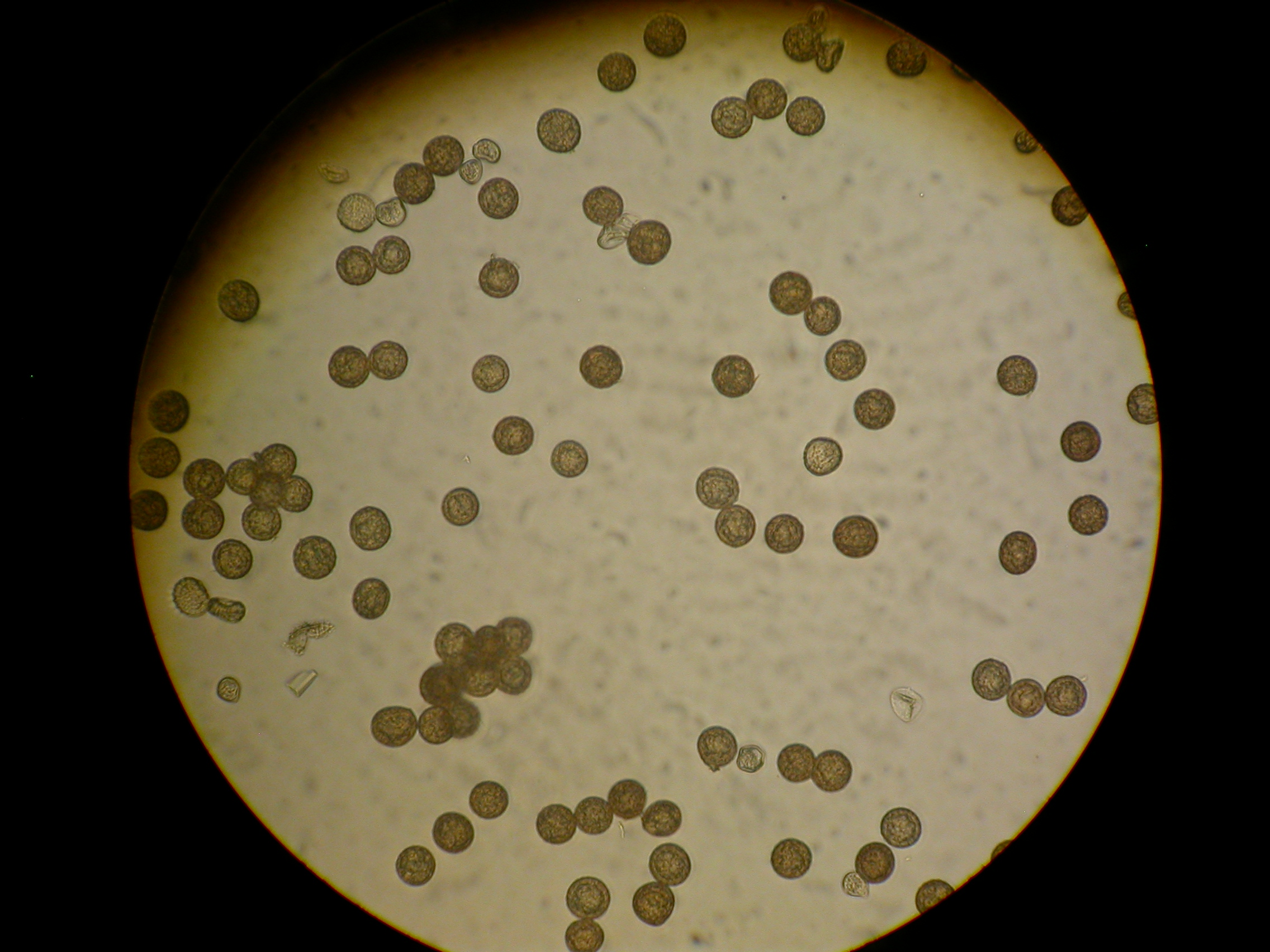 Споры грибов семена. Tilletia caries споры. Tilletia tritici споры. Микроскопия Tilletia tritici микроскопия. Tilletia Indica споры.