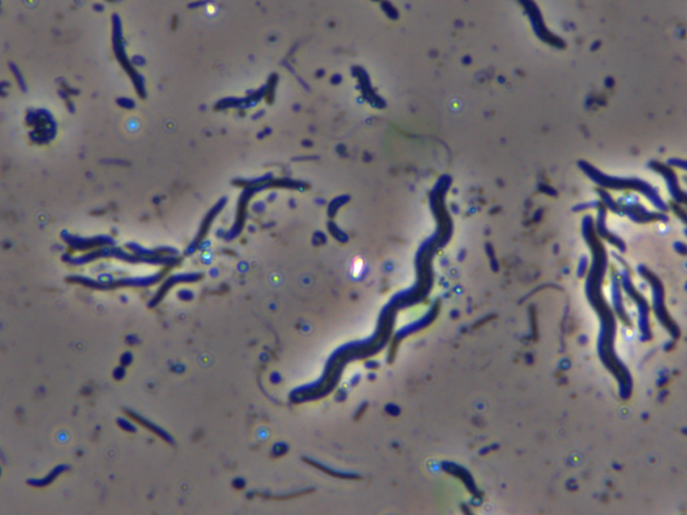 types of spiral bacteria