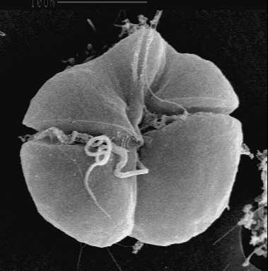 Karenia brevis, the primary dinoflagellate organism responsible for brevetoxin production.
